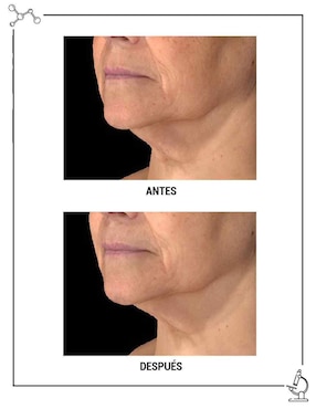 Crema facial recomendada para prevenir signos de la edad día y noche Super Multi-Corrective Cream SPF 30 Kiehl's todo tipo piel