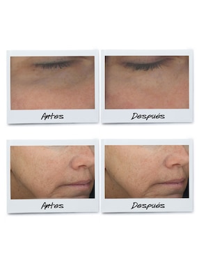 Sérum antiedad para ojos Powerful-Strength Line-Reducing & Dark Circle-Diminishing Vitamin C Kiehl'S todo tipo piel