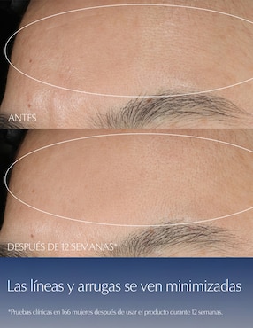 EL NEW ANR SYNCHRON MULTI COMP 50ML