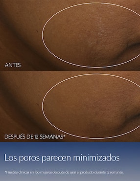 EL NEW ANR SYNCHRON MULTI COMP 50ML