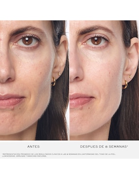 Sérum antiedad facial Rénergie Lancôme Multi-Lift todo tipo piel
