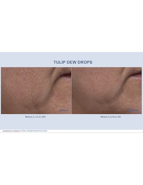 Mascarilla Dutch para hidratar Bloomeffects