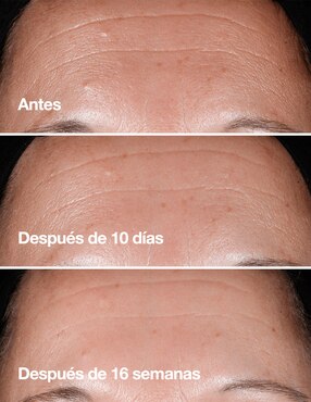 EL SMART CLINICAL REPAIR 100ML