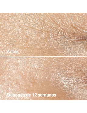 Crema facial recomendada para prevenir signos de la edad día y noche Clinique para todo tipo piel