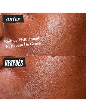 Sérum matificante facial Ultra Pure High-Potency Kiehl's todo tipo de piel