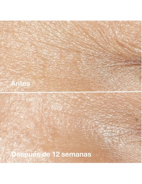 Crema facial recomendada para prevenir signos de la edad de día y noche Clinique Smart Clinical Repair para todo tipo piel