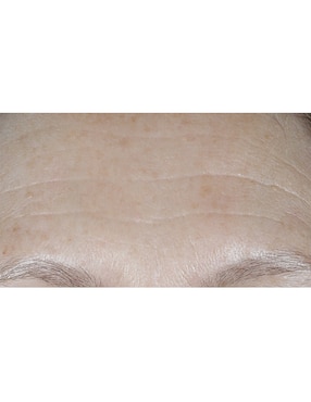 Crema facial recomendada para prevenir signos de la edad día Clinique Smart Clinical Repair Wrinkle Correcting Cream Spf 30 para todo tipo piel