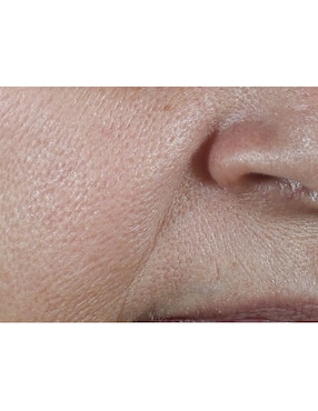 Crema facial recomendada para prevenir signos de la edad día Clinique Smart Clinical Repair Wrinkle Correcting Cream Spf 30 para todo tipo piel