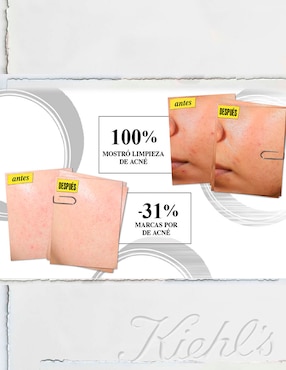 Hidratante facial Expertly Clear Moisturizer for Acne Prone Skin with Salicylic Acid Kiehl's