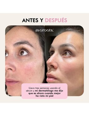 Kit de sérum facial Super Hydra Avoroots todo tipo de piel