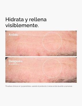 Tratamiento facial Hyaluronic Acid The Ordinary