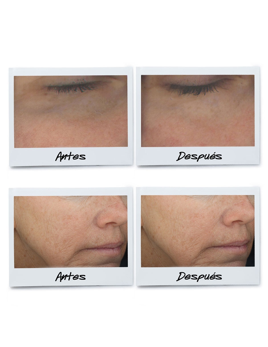 Sérum antiedad para ojos Powerful-Strength Line-Reducing & Dark Circle-Diminishing Vitamin C todo tipo piel 8