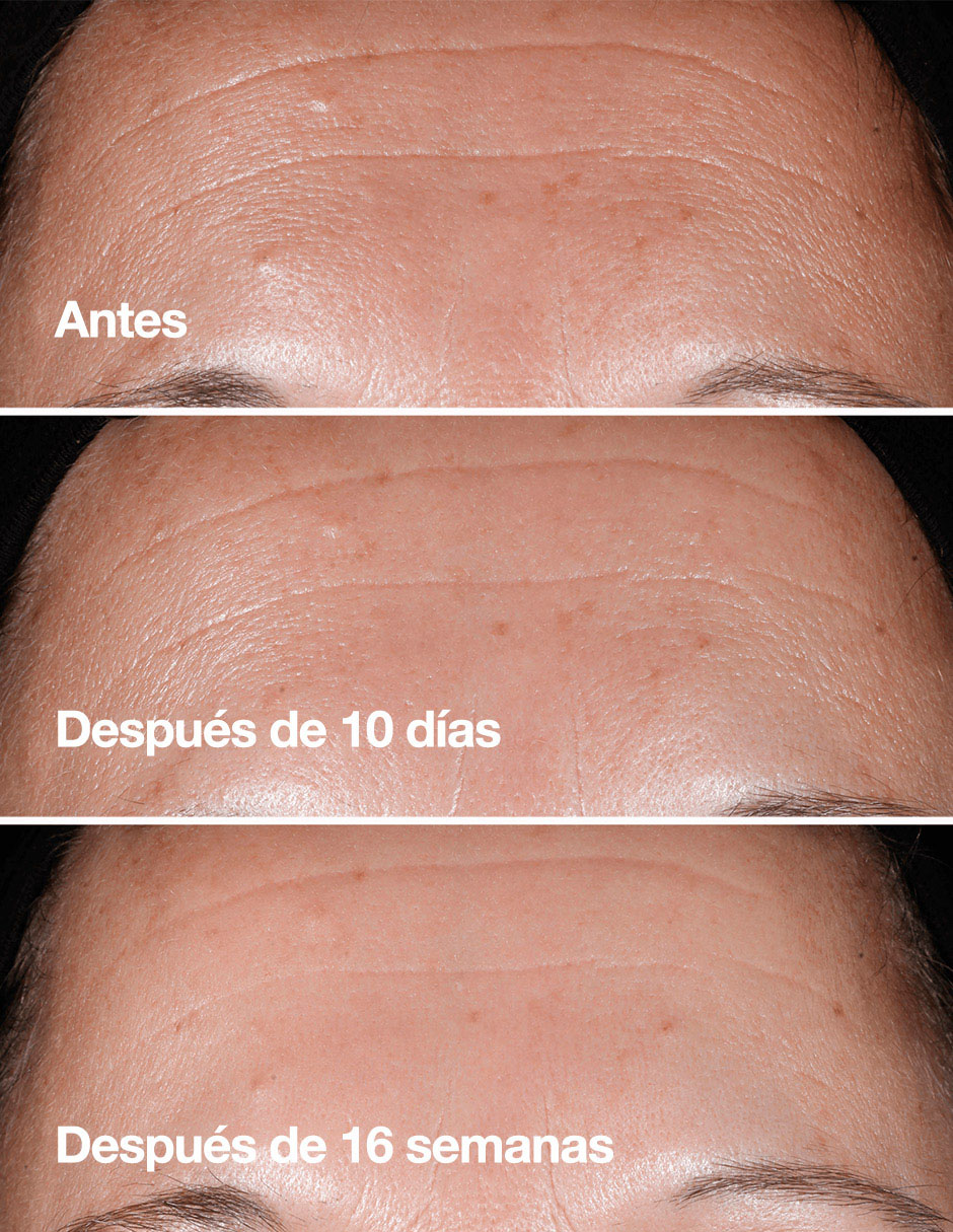 Sérum antiedad Smart Cinical Repair todo tipo piel 7