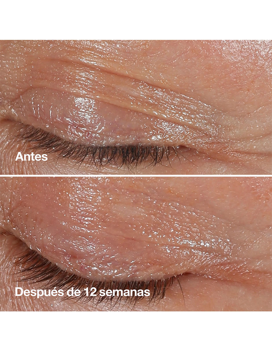 Crema para ojos recomendada para prevenir signos de la edad día y noche Smart Clinical para todo tipo piel 4