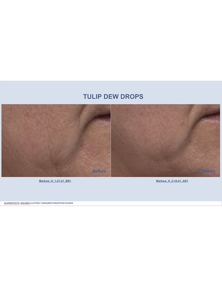 Mascarilla Dutch para hidratar 5