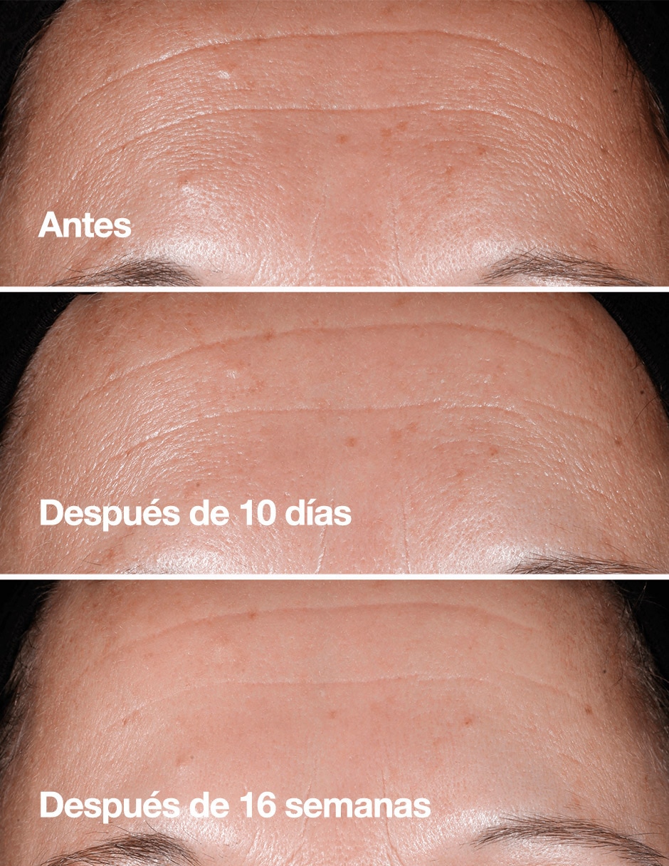 EL SMART CLINICAL REPAIR 100ML 17