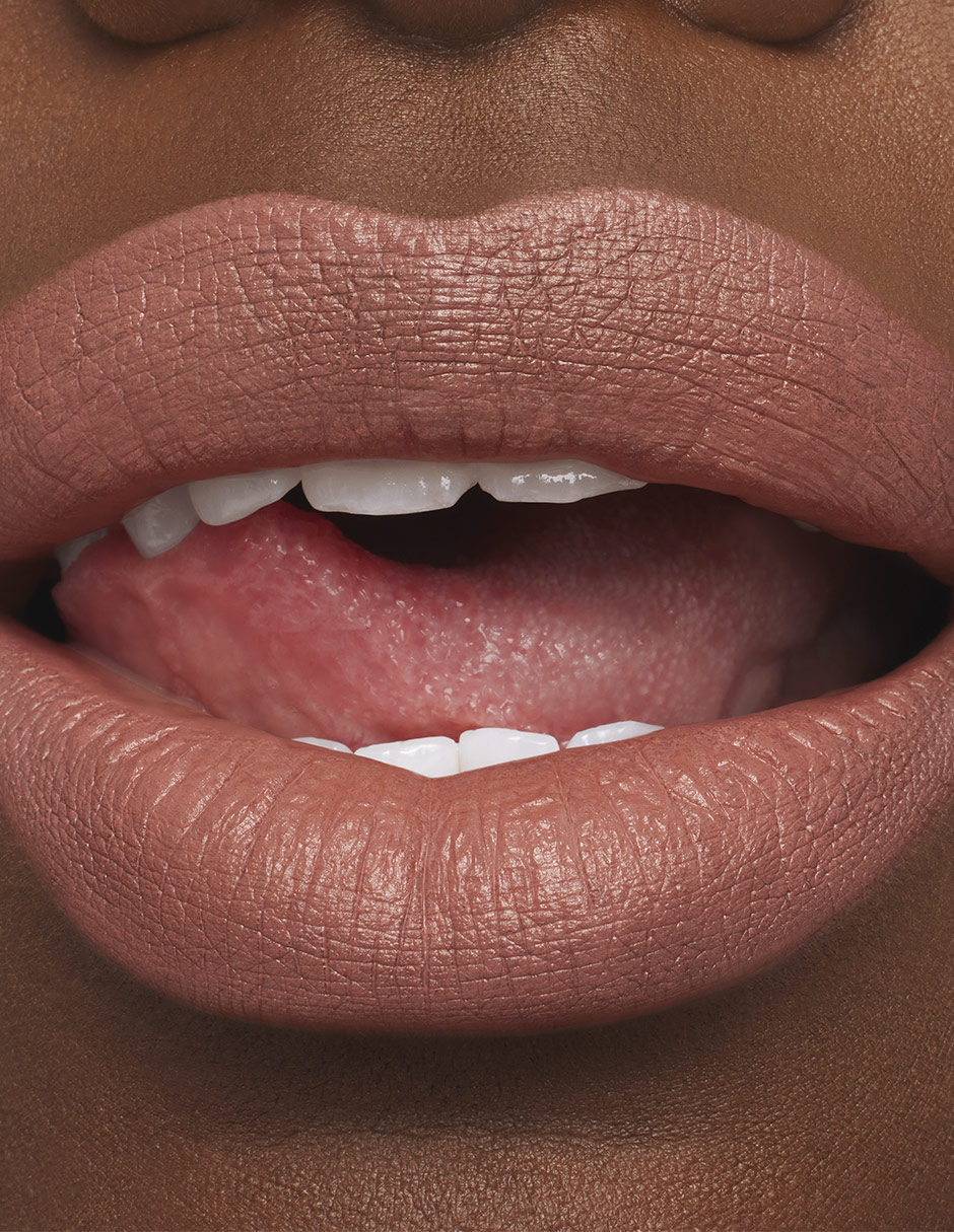 Labial mate Mac M·A·Cximal