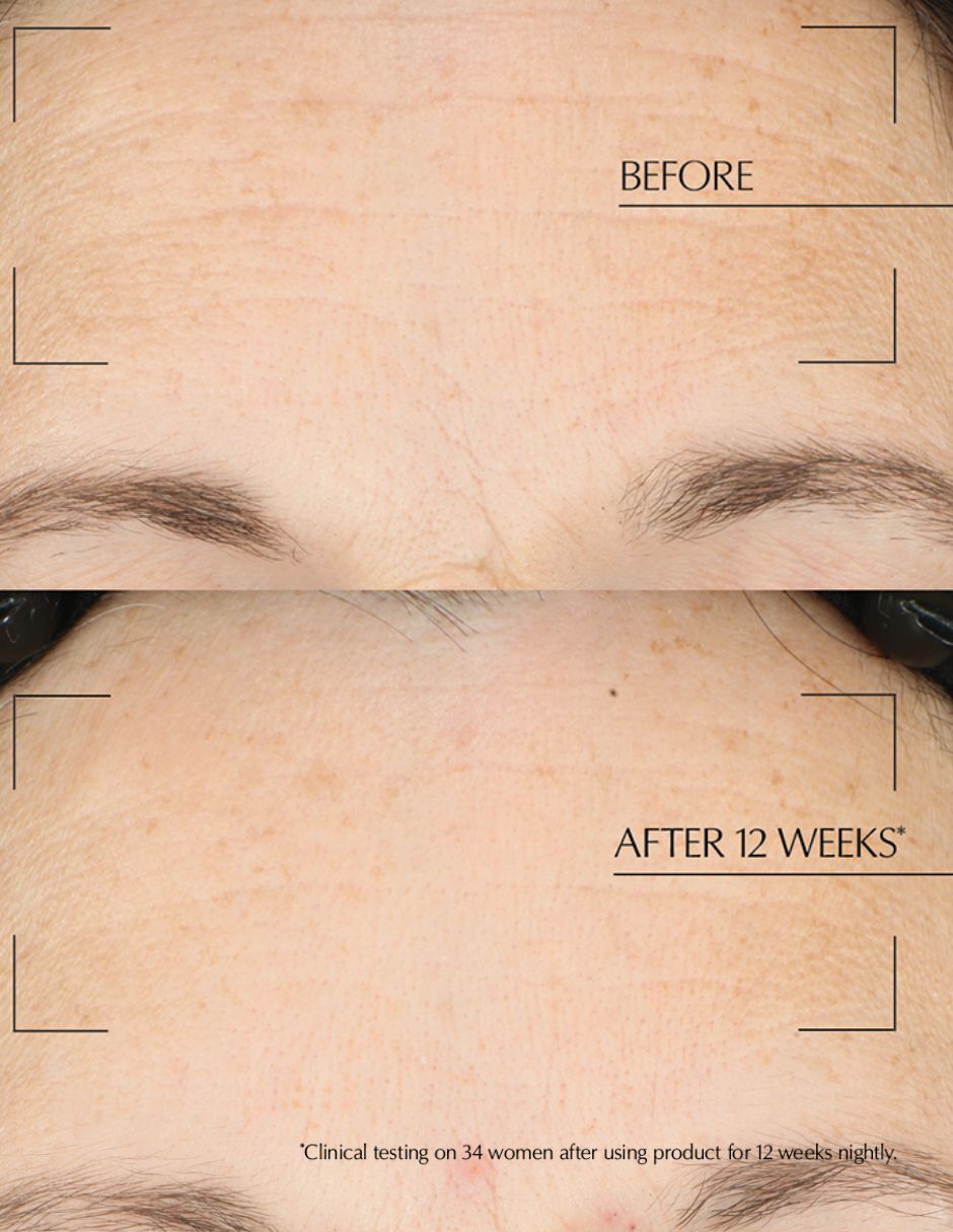 Tratamiento facial Reparación Nocturna Avanzada Durante La Noche reparador Anr 3