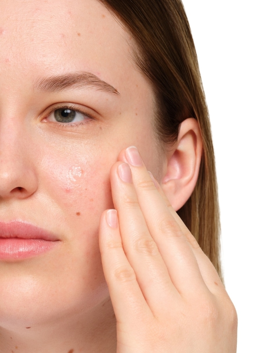 Sérum facial Salicylic Acid 2% Solution (Solución de çcido Salicílico Al 2%) The Ordinary todo tipo piel 5
