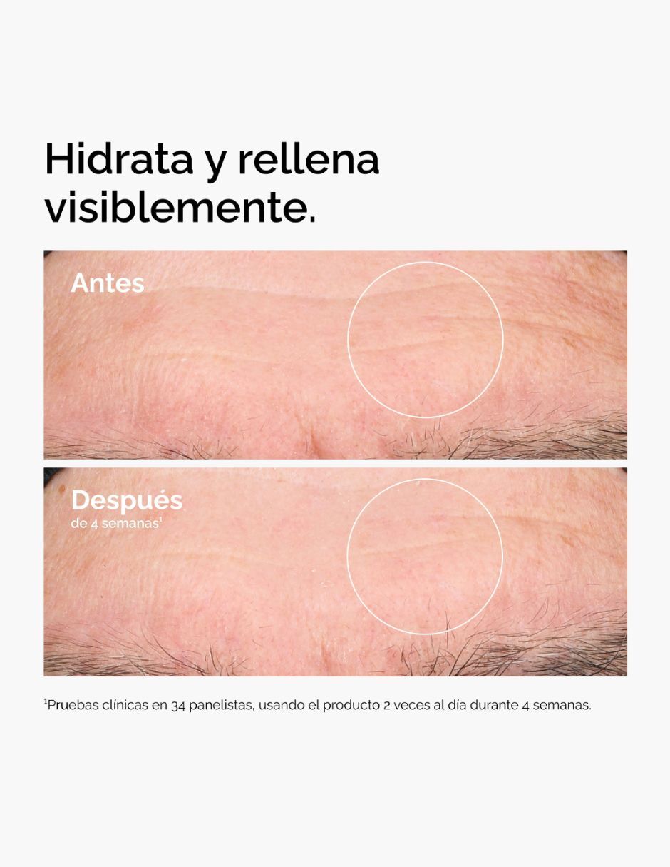 Tratamiento facial Hyaluronic Acid 5