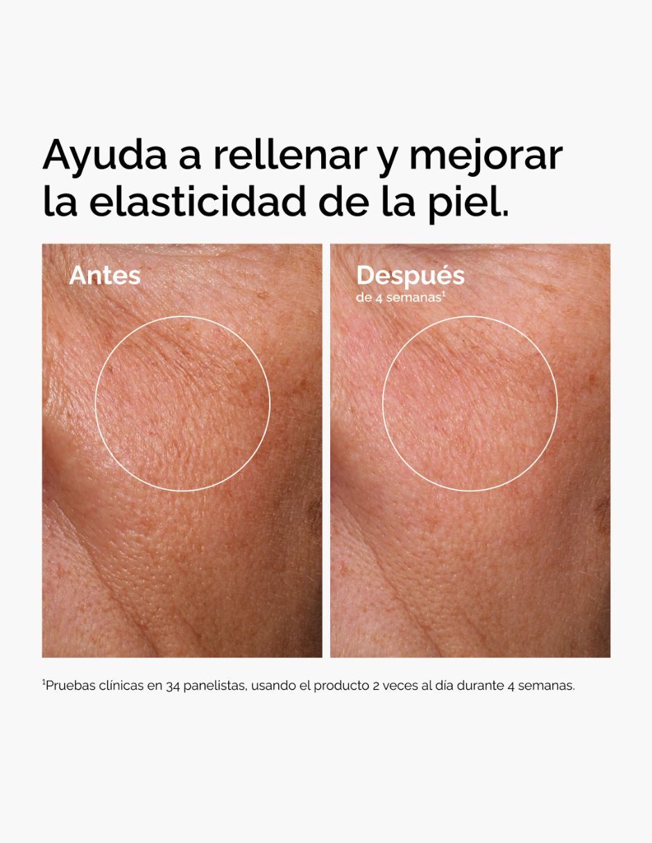 Tratamiento facial Hyaluronic Acid 6